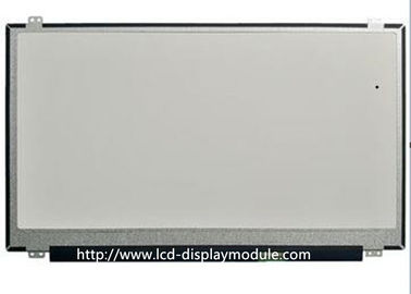 ماژول نمایشگر TFT مربعی IPS رابط MCU SPI برای ساعت هوشمند پوشیدنی